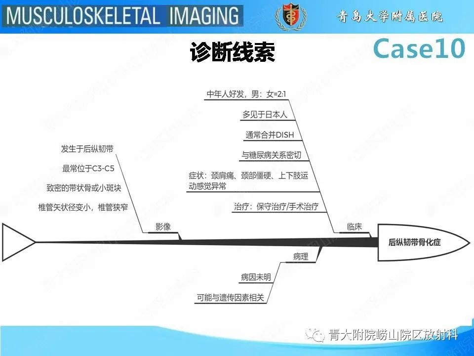 【PPT】后纵韧带骨化症