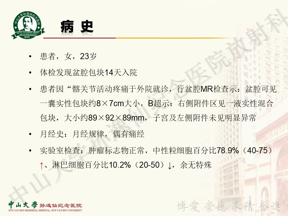 【病例】盆腔Castleman病 （巨大淋巴结增生症）1例MR