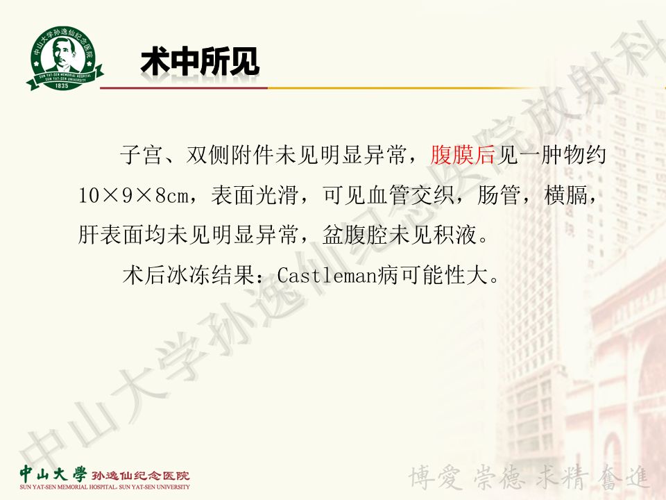 【病例】盆腔Castleman病 （巨大淋巴结增生症）1例MR