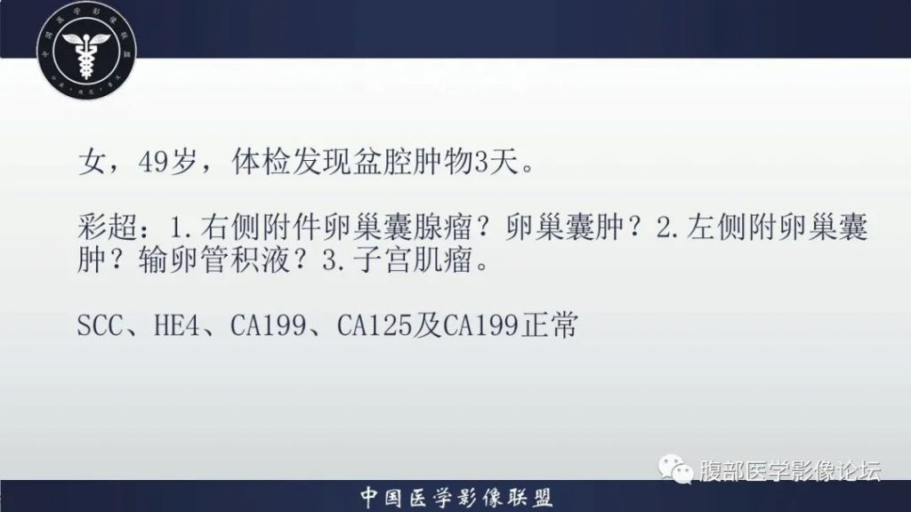 【病例】卵巢囊性腺纤维瘤1例CT影像