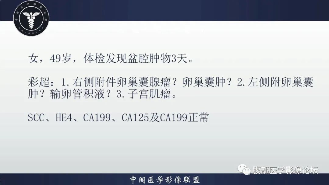 【病例】卵巢囊性腺纤维瘤1例CT影像