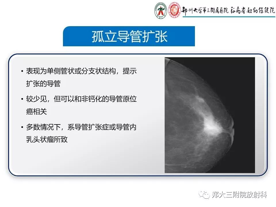 【PPT】乳腺X线特殊征象与合并征象