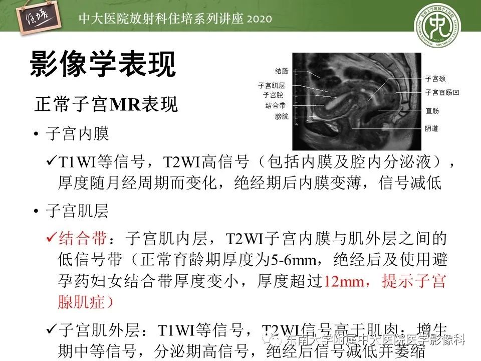 【PPT】子宫内膜异位症与子宫腺肌症的MR诊断