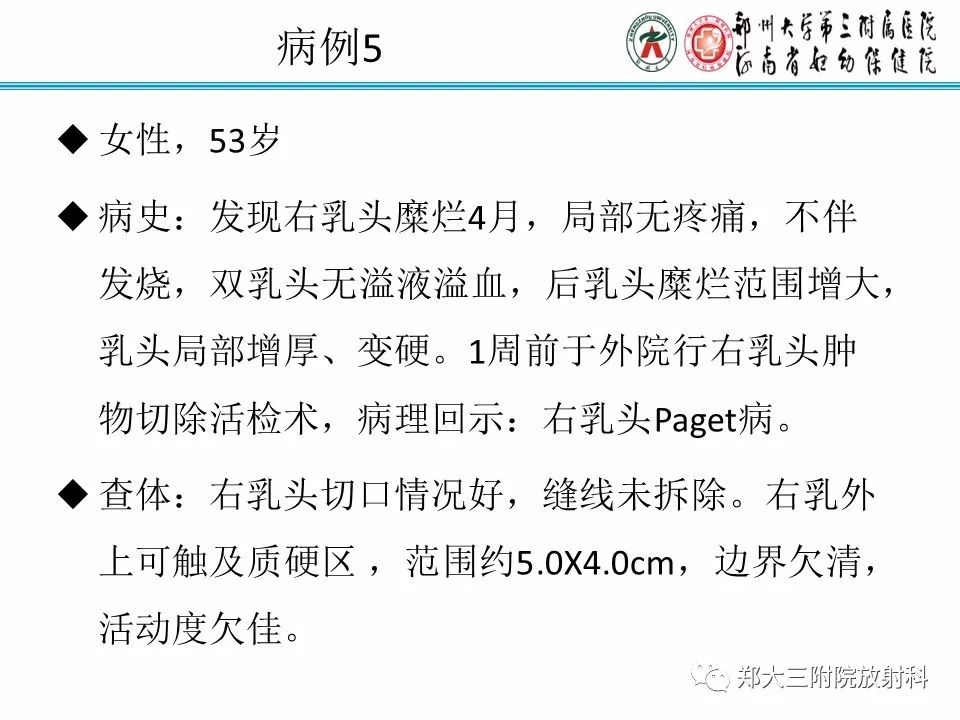 【PPT】乳腺X线病例分享