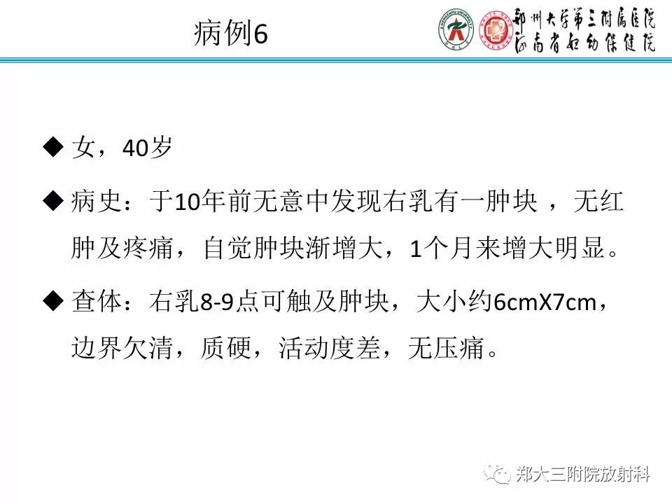 【PPT】乳腺X线病例分享