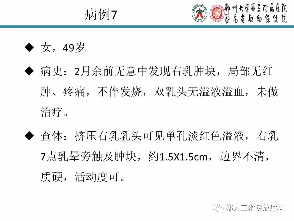 【PPT】乳腺X线病例分享