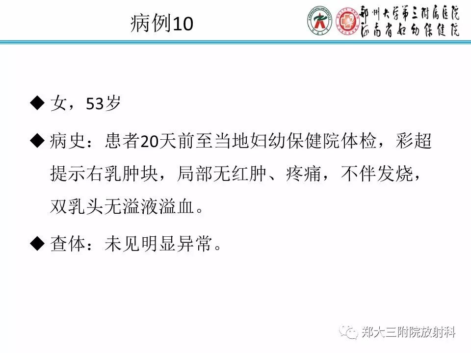 【PPT】乳腺X线病例分享