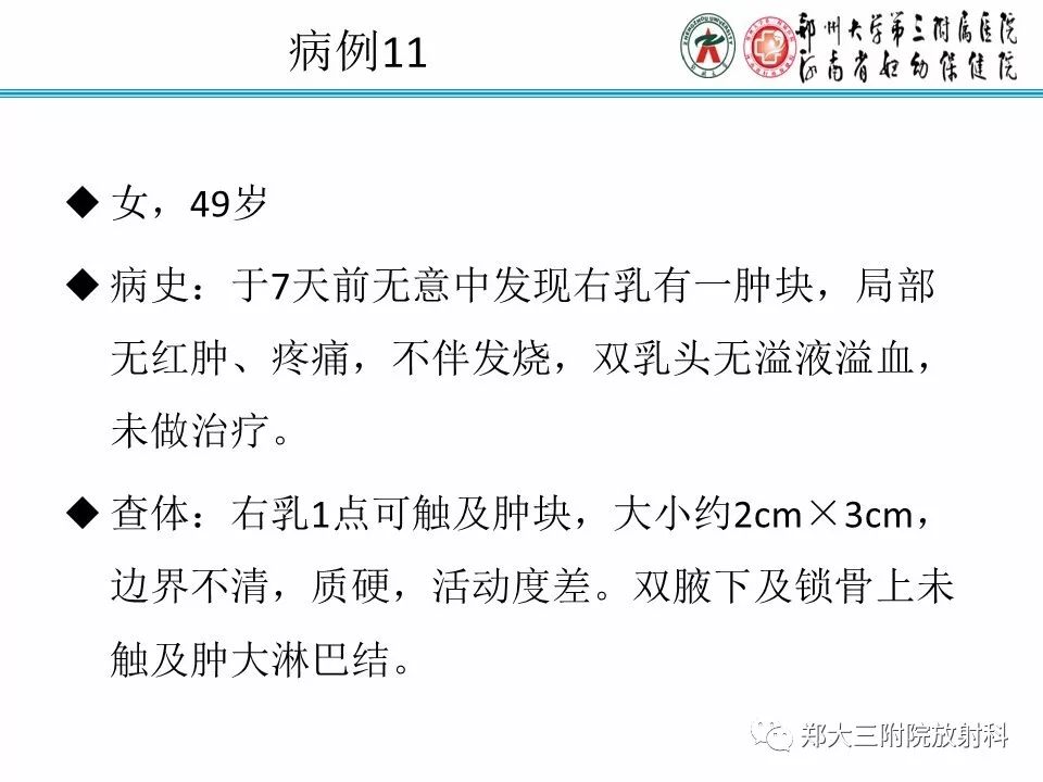 【PPT】乳腺X线病例分享