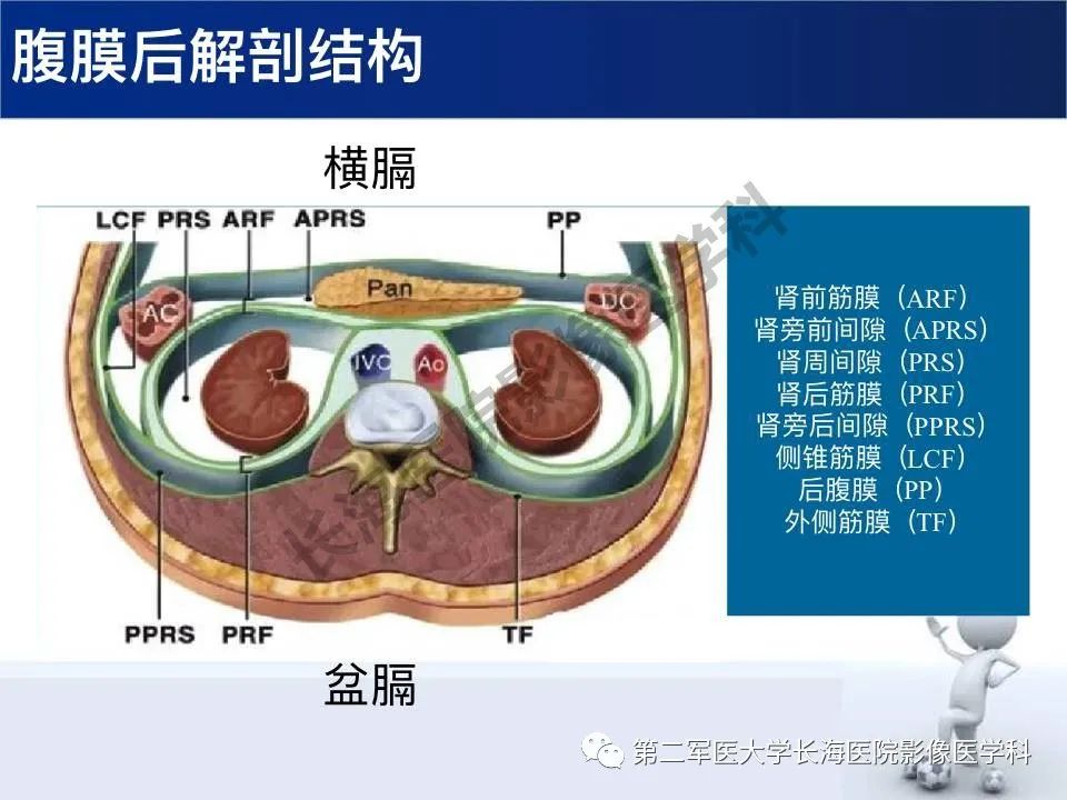 【PPT】原发性腹膜后含脂肪肿瘤影像学表现