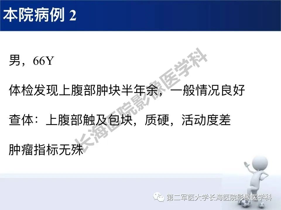 【PPT】原发性腹膜后含脂肪肿瘤影像学表现