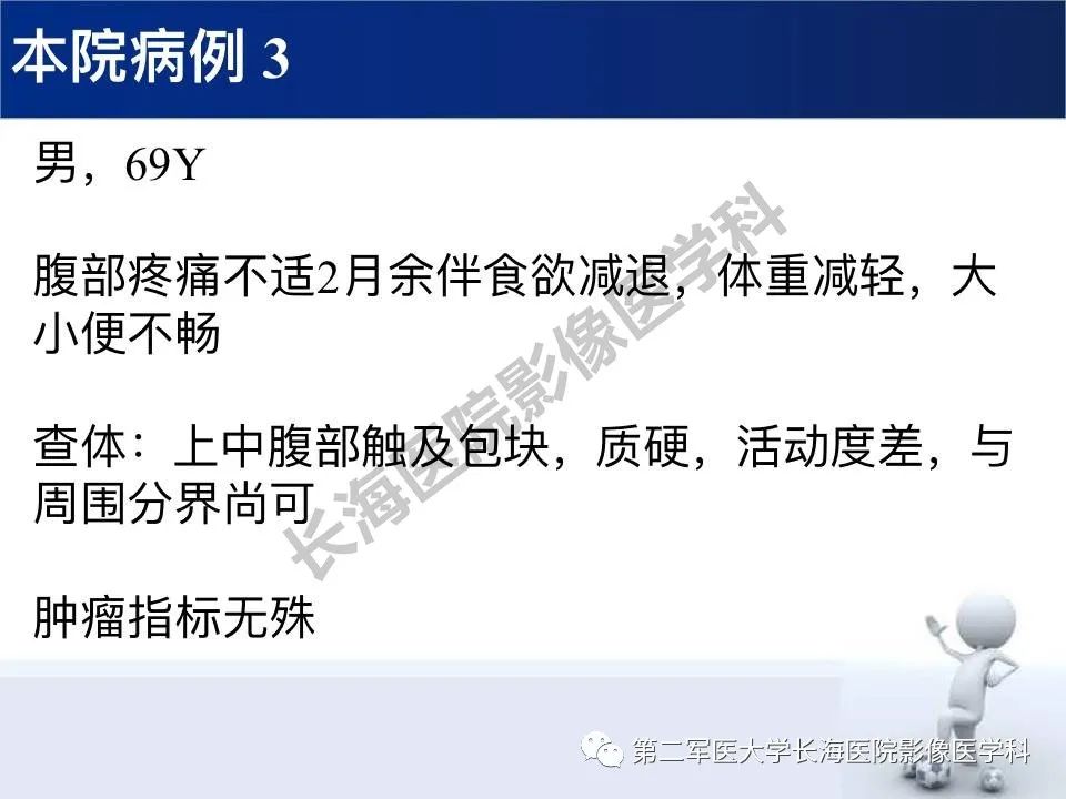 【PPT】原发性腹膜后含脂肪肿瘤影像学表现
