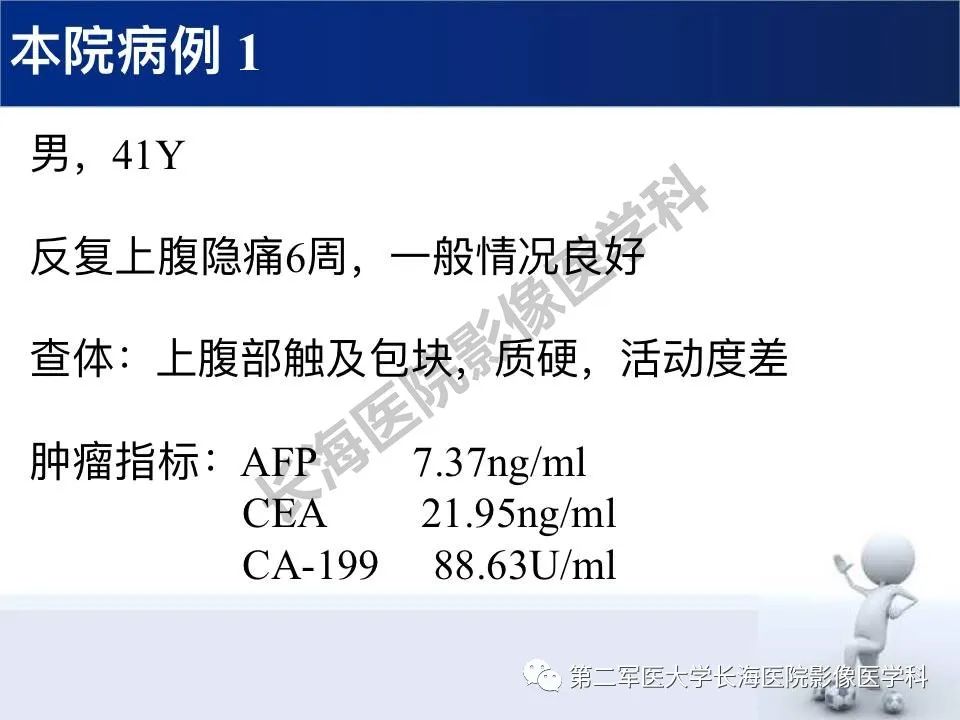 【PPT】原发性腹膜后含脂肪肿瘤影像学表现