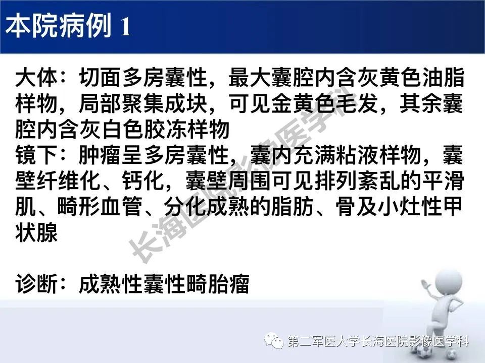 【PPT】原发性腹膜后含脂肪肿瘤影像学表现