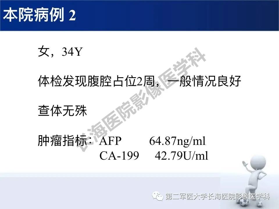【PPT】原发性腹膜后含脂肪肿瘤影像学表现