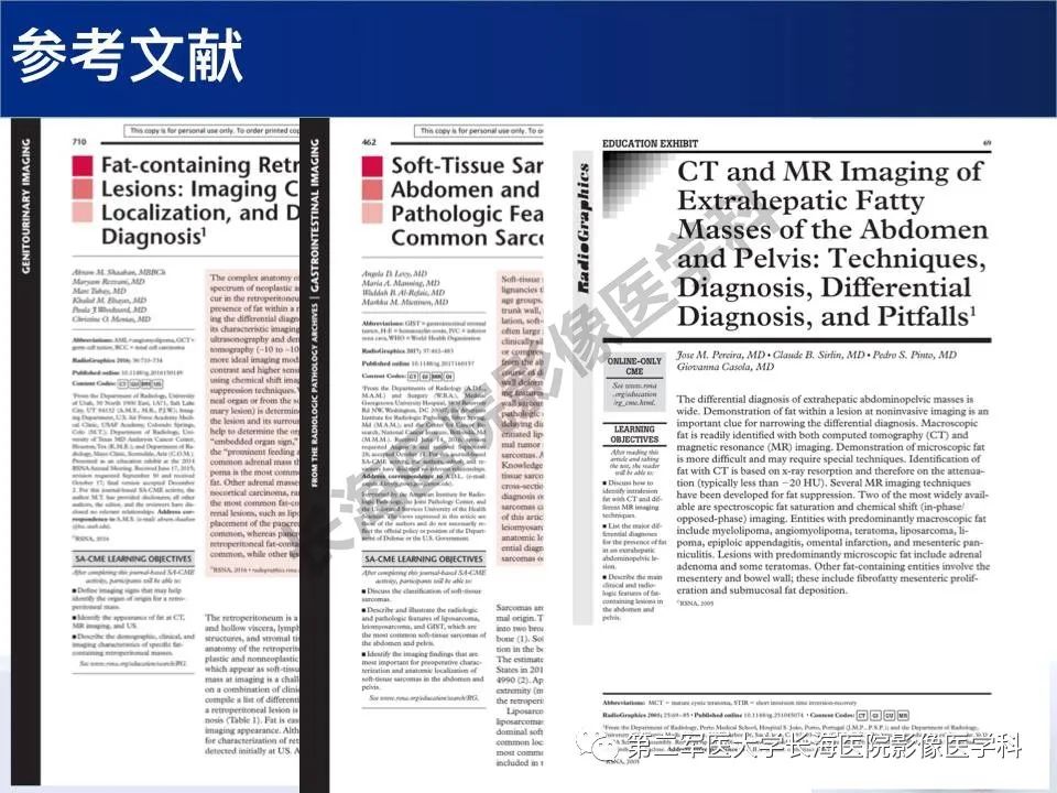 【PPT】原发性腹膜后含脂肪肿瘤影像学表现
