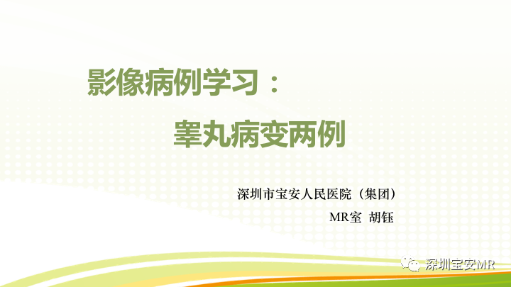 【PPT】影像病例学习：睾丸病变2例