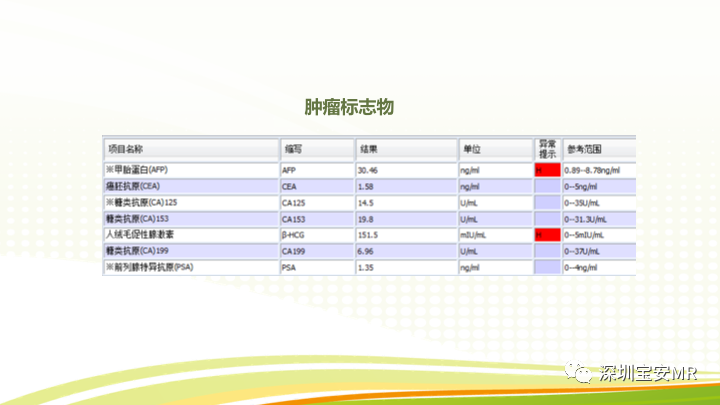 【PPT】影像病例学习：睾丸病变2例