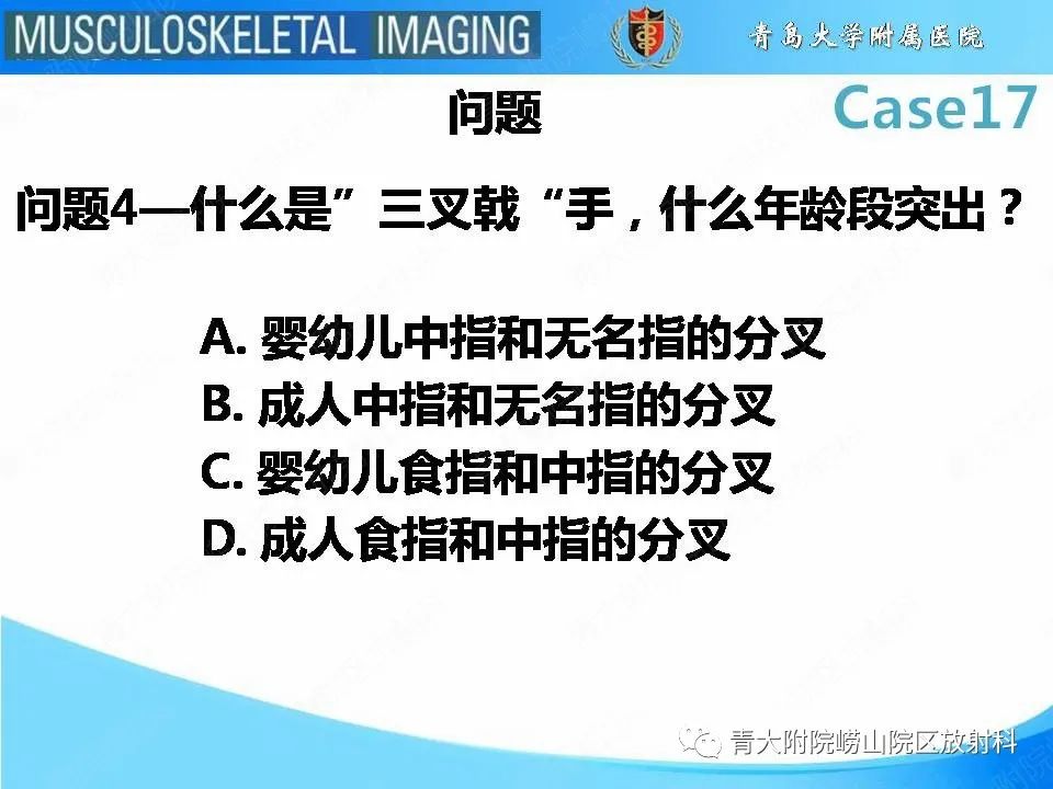 【PPT】软骨发育不全