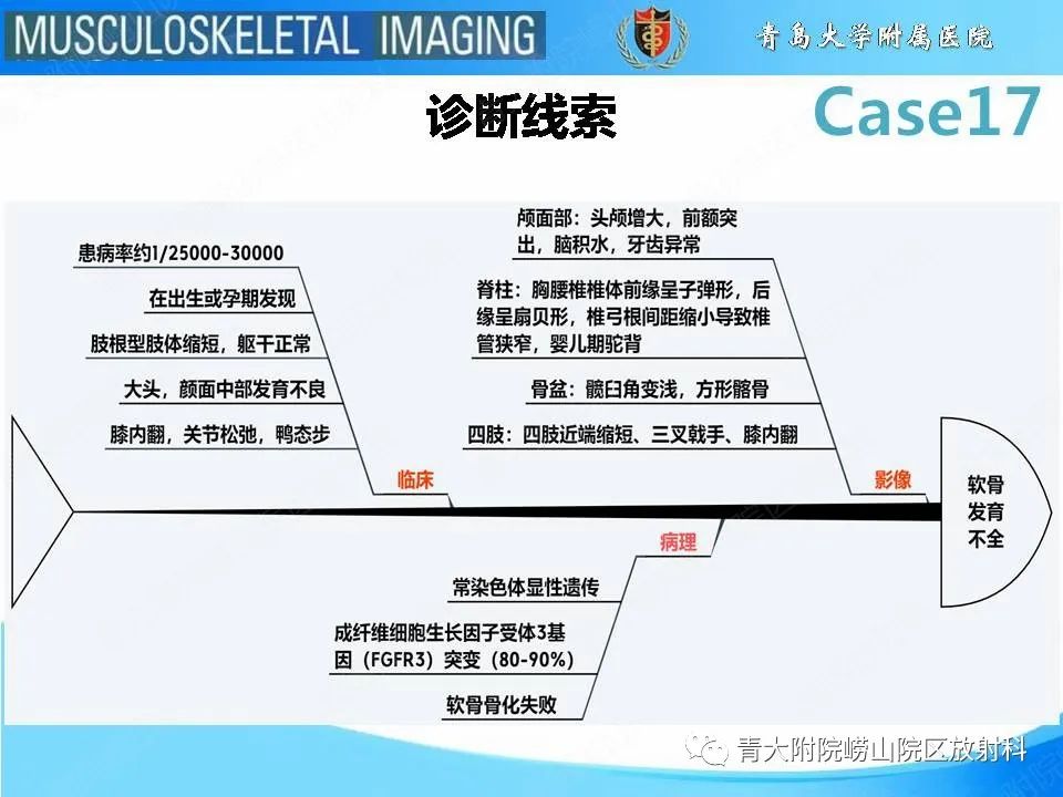 【PPT】软骨发育不全