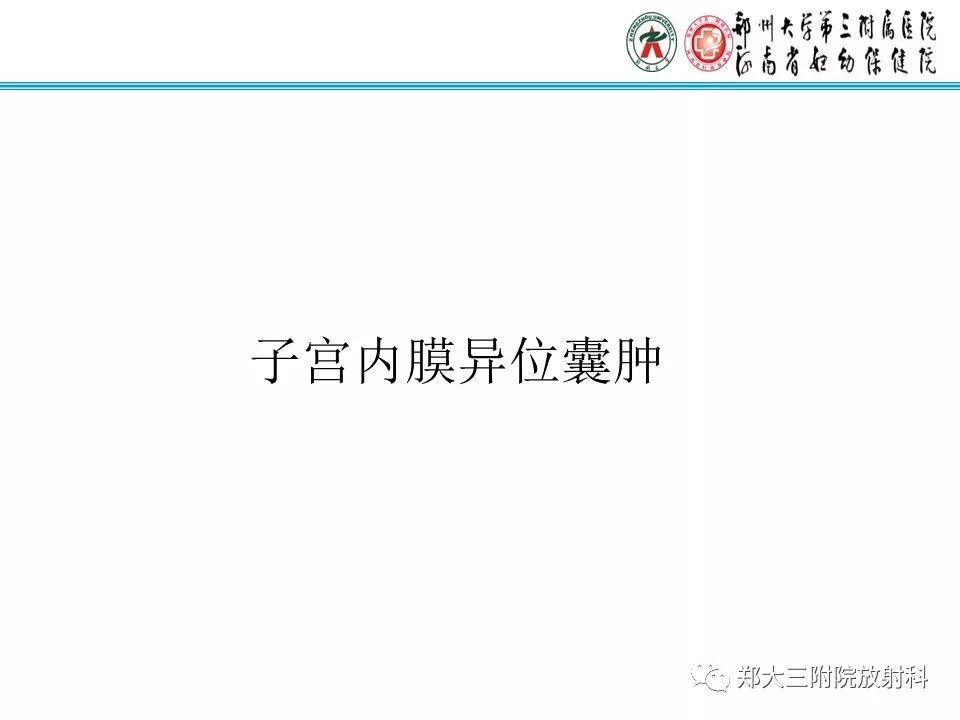 【PPT】子宫内膜异位囊肿