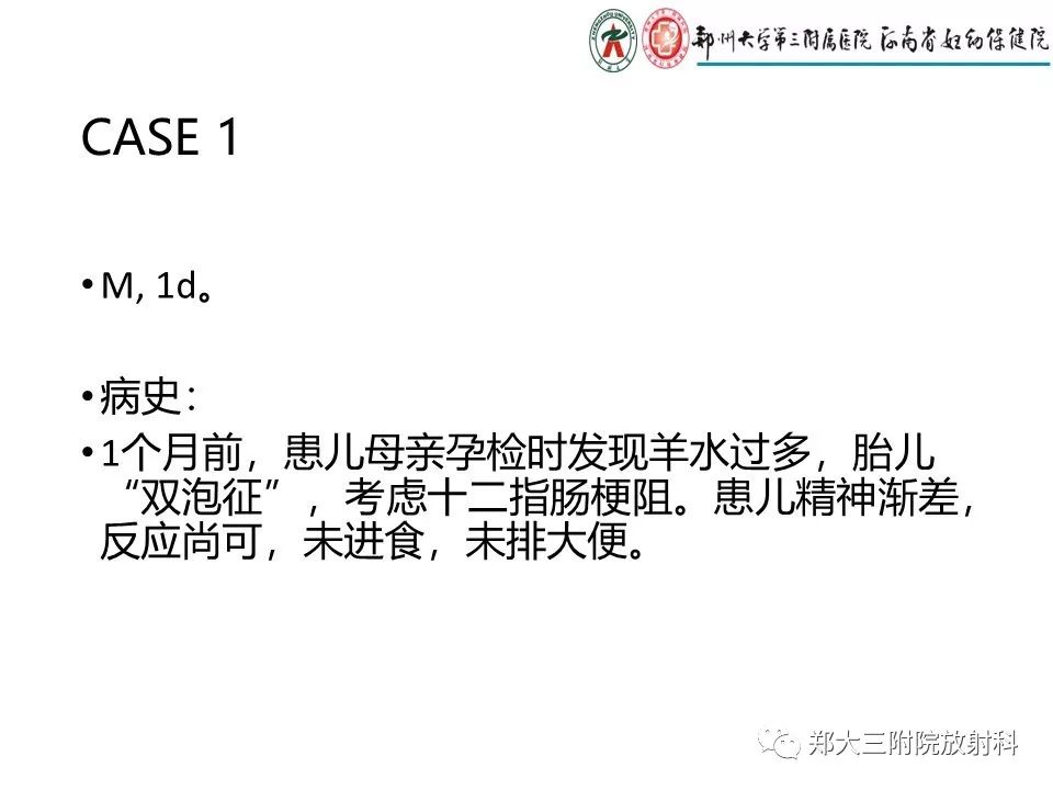 【PPT】十二指肠梗阻病例分析