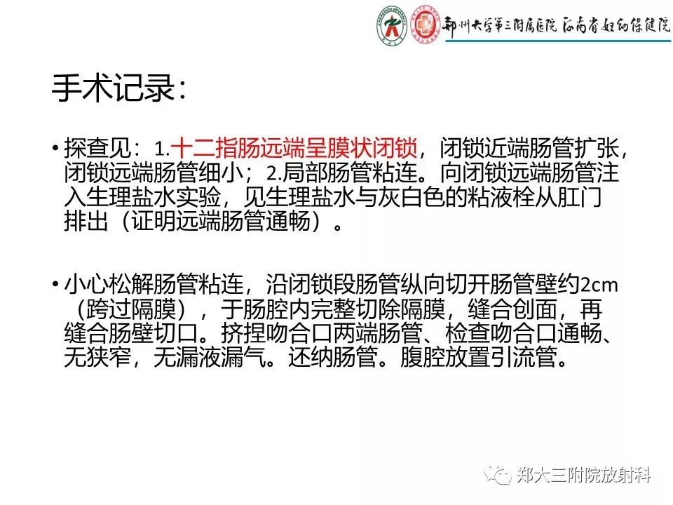 【PPT】十二指肠梗阻病例分析