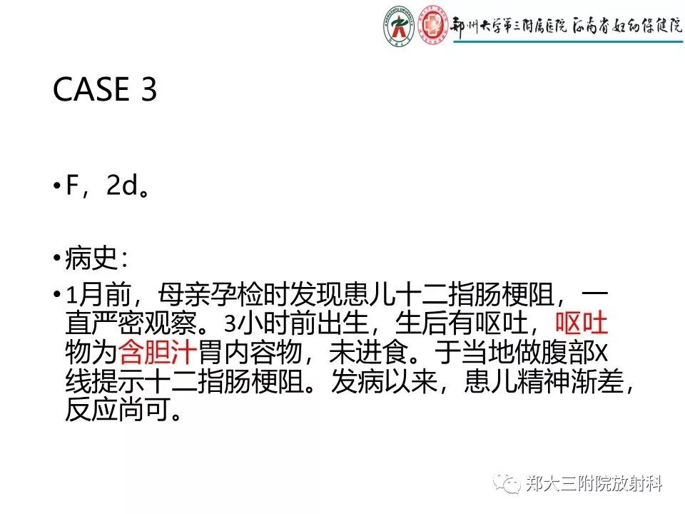 【PPT】十二指肠梗阻病例分析