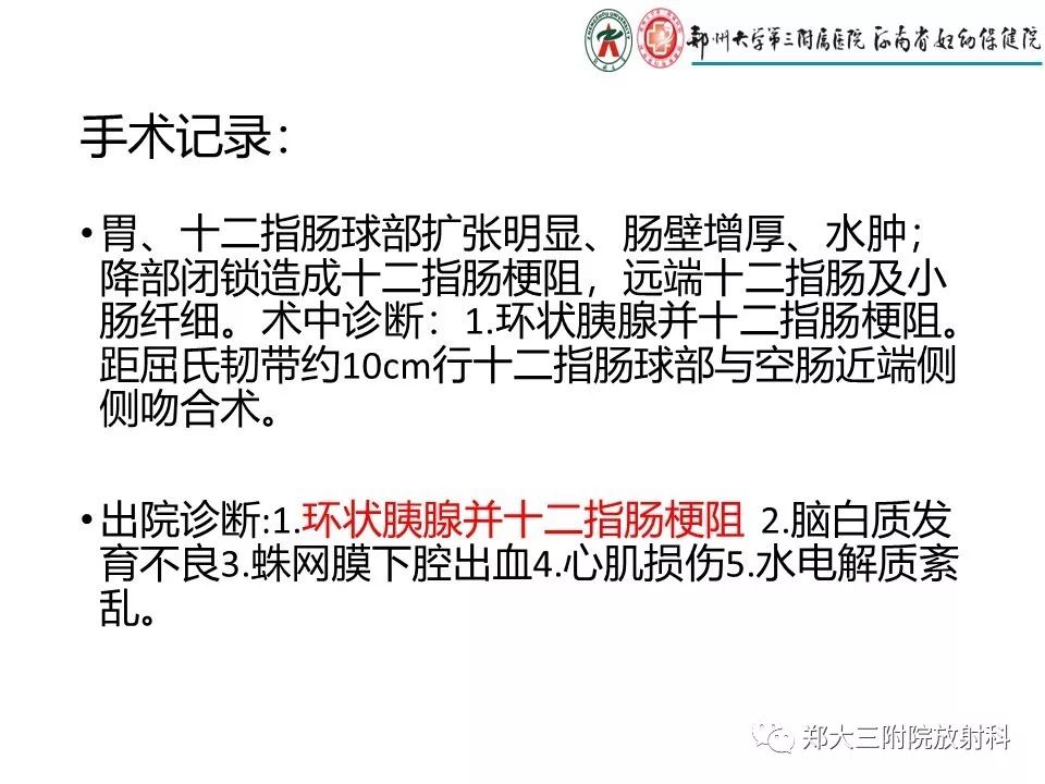 【PPT】十二指肠梗阻病例分析