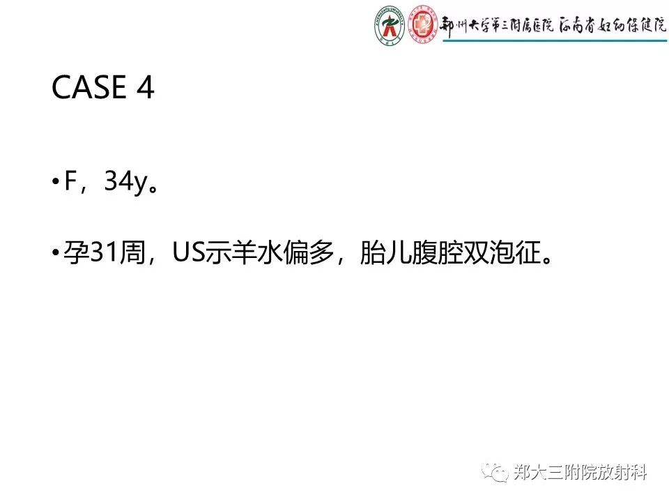 【PPT】十二指肠梗阻病例分析
