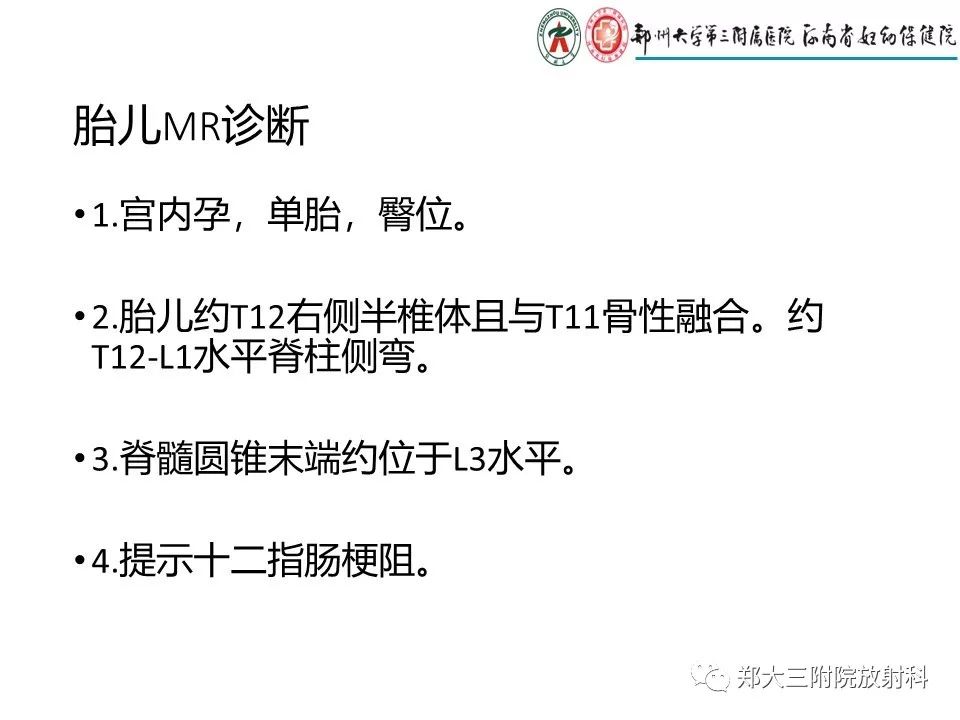 【PPT】十二指肠梗阻病例分析