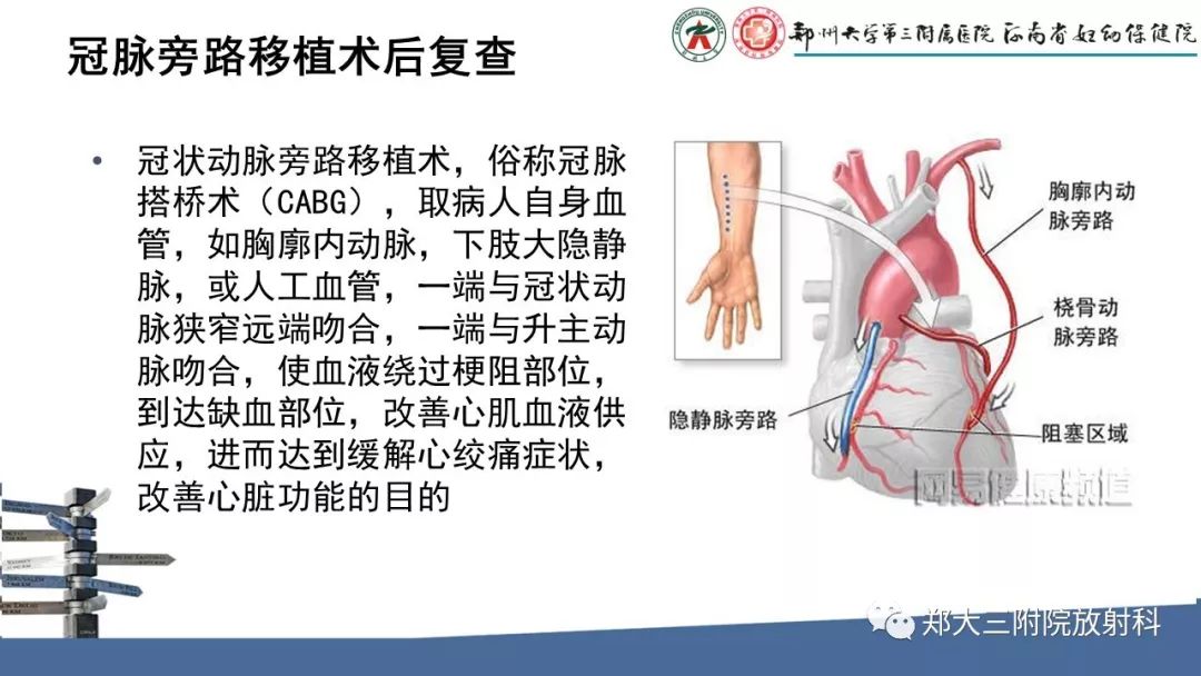 【PPT】冠状动脉CTA的临床应用