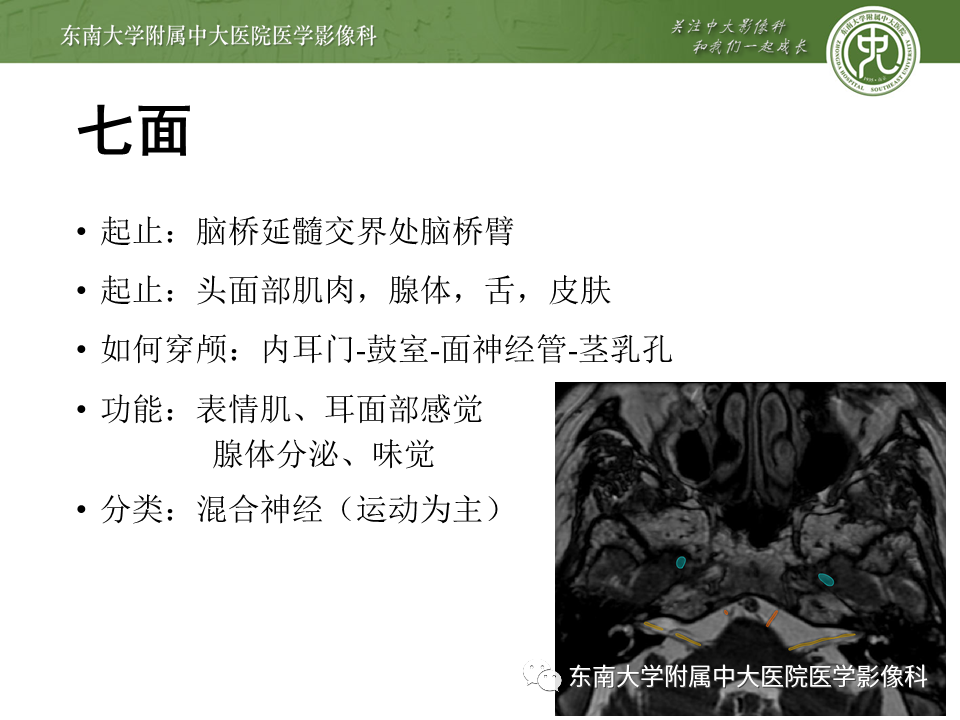 【PPT】颅神经原发肿瘤