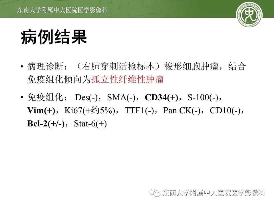 【PPT】胸膜孤立性纤维瘤