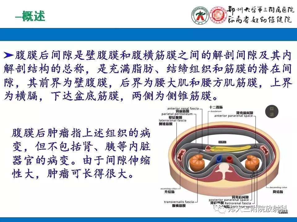 【PPT】腹膜后平滑肌肉瘤的影像表现