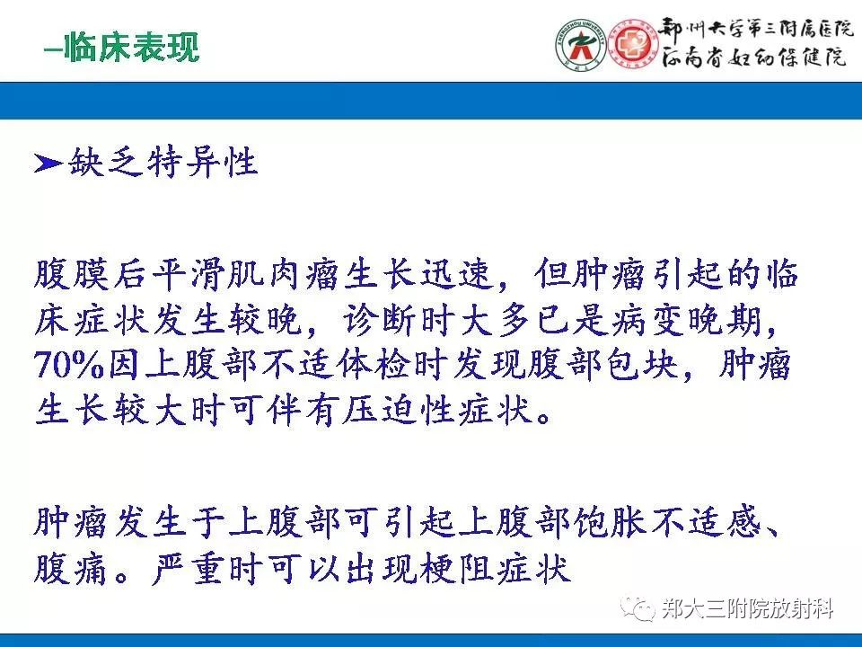 【PPT】腹膜后平滑肌肉瘤的影像表现