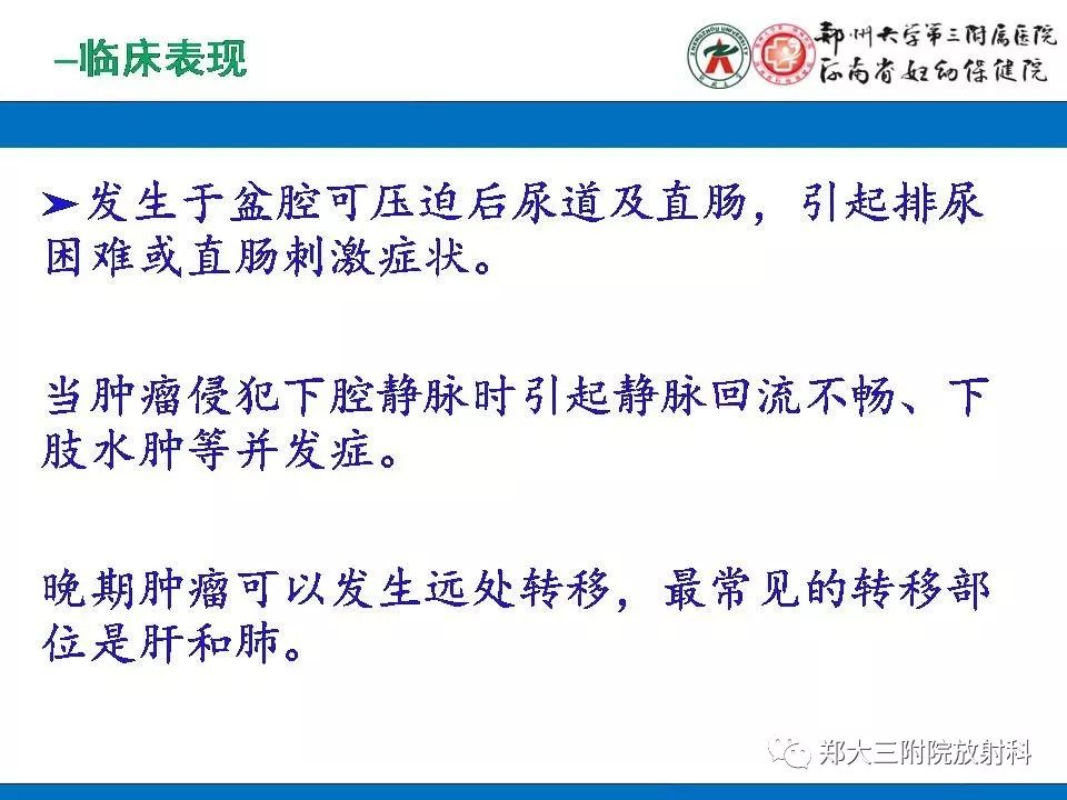 【PPT】腹膜后平滑肌肉瘤的影像表现