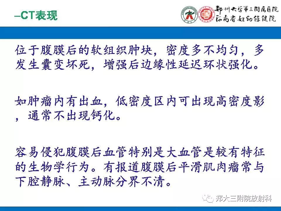 【PPT】腹膜后平滑肌肉瘤的影像表现