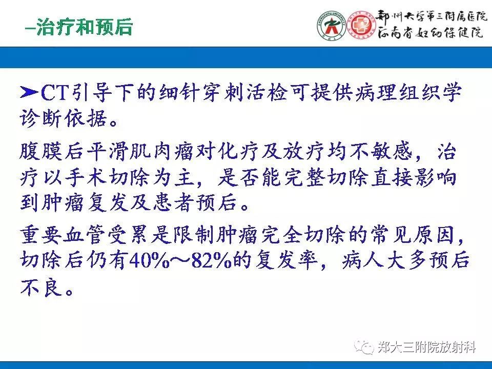【PPT】腹膜后平滑肌肉瘤的影像表现