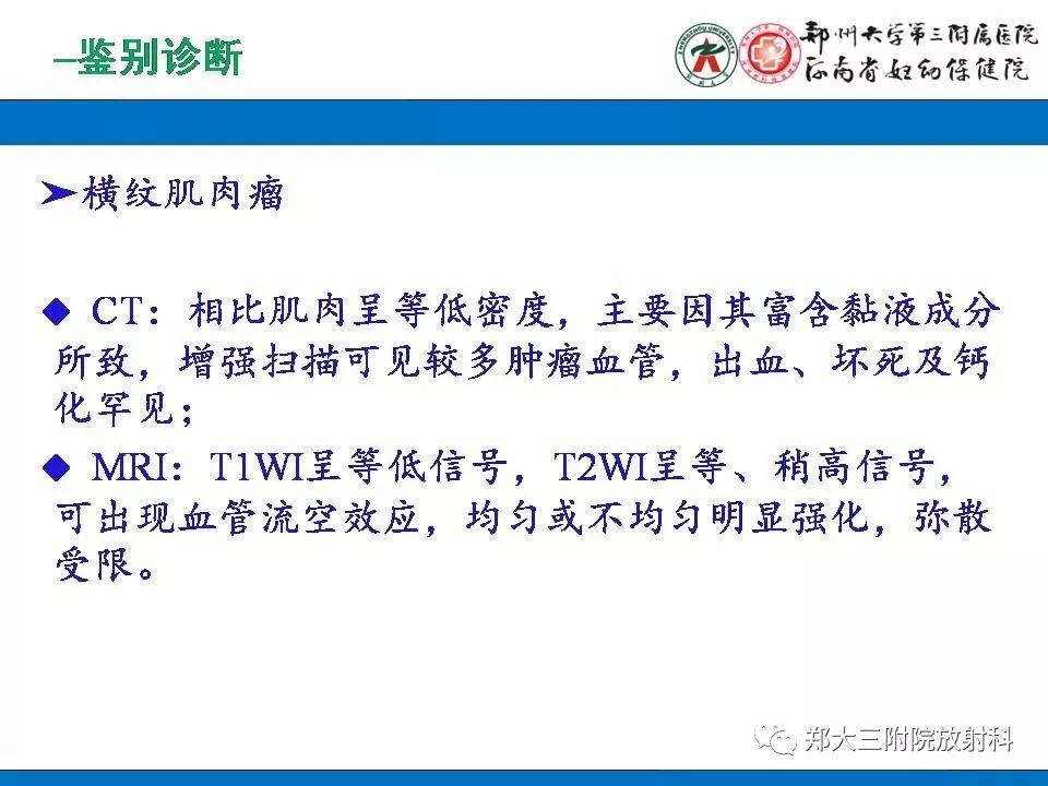 【PPT】腹膜后平滑肌肉瘤的影像表现