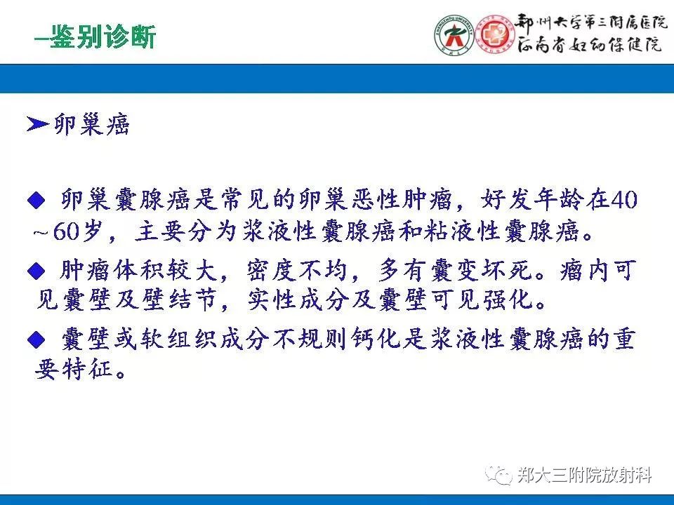 【PPT】腹膜后平滑肌肉瘤的影像表现