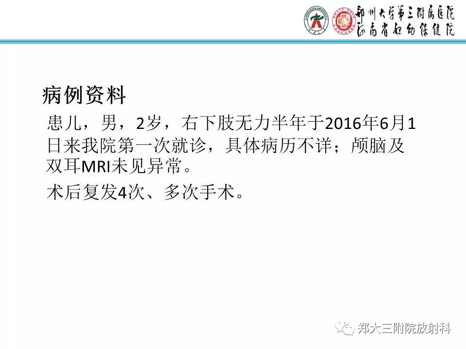 【PPT】韧带样纤维瘤