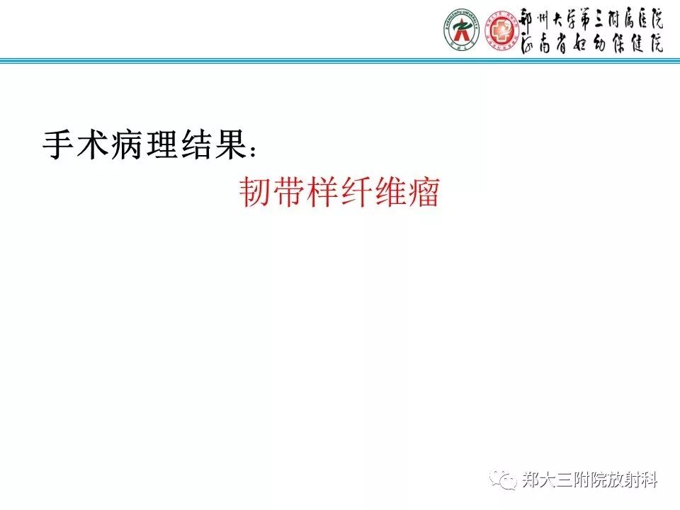 【PPT】韧带样纤维瘤