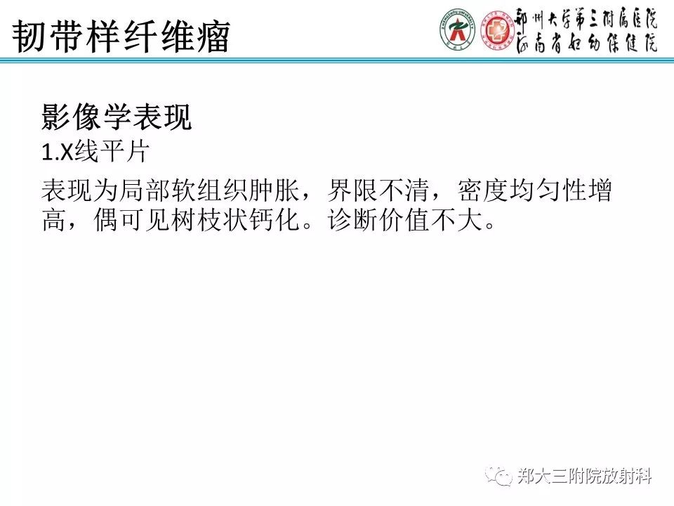 【PPT】韧带样纤维瘤