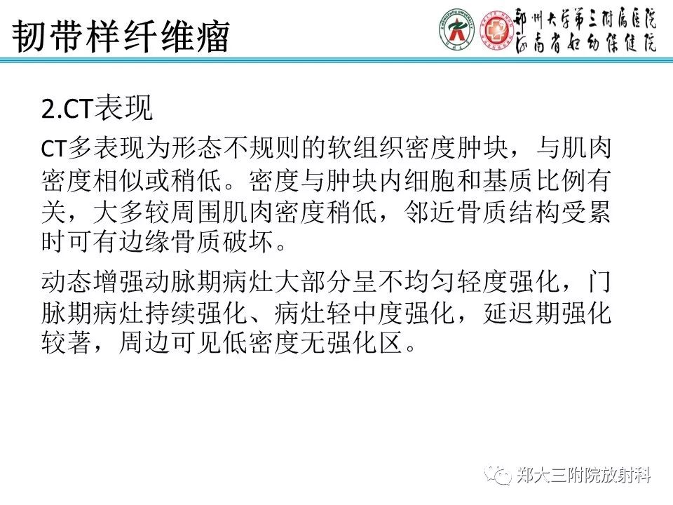 【PPT】韧带样纤维瘤