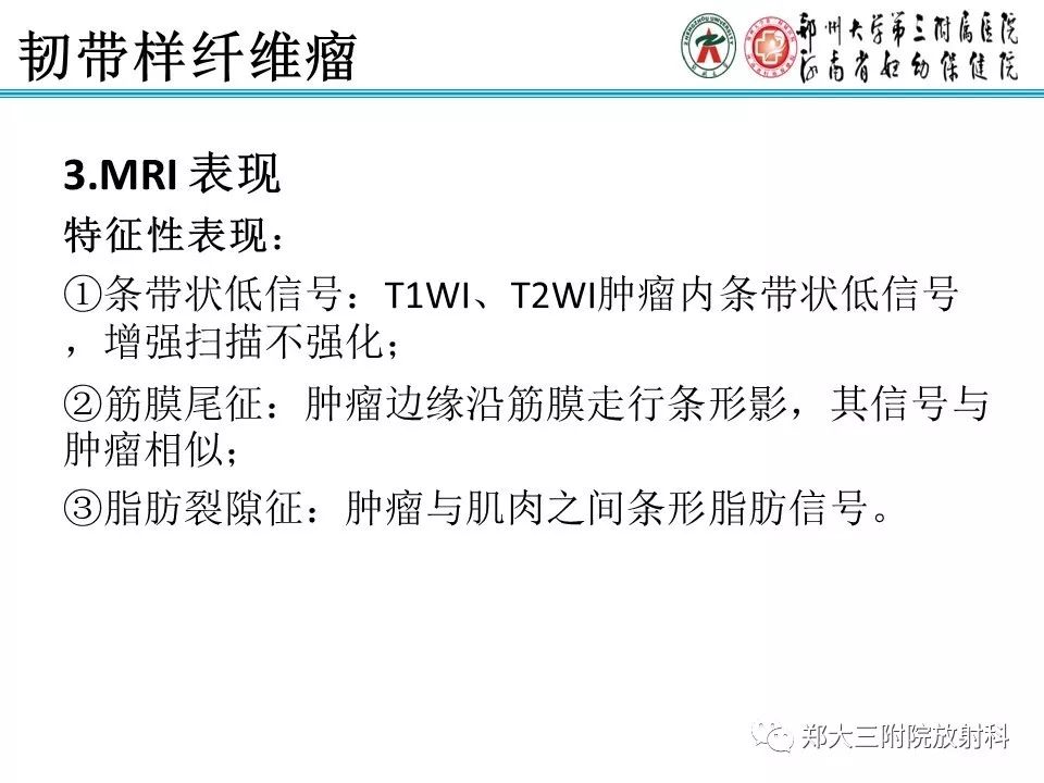 【PPT】韧带样纤维瘤