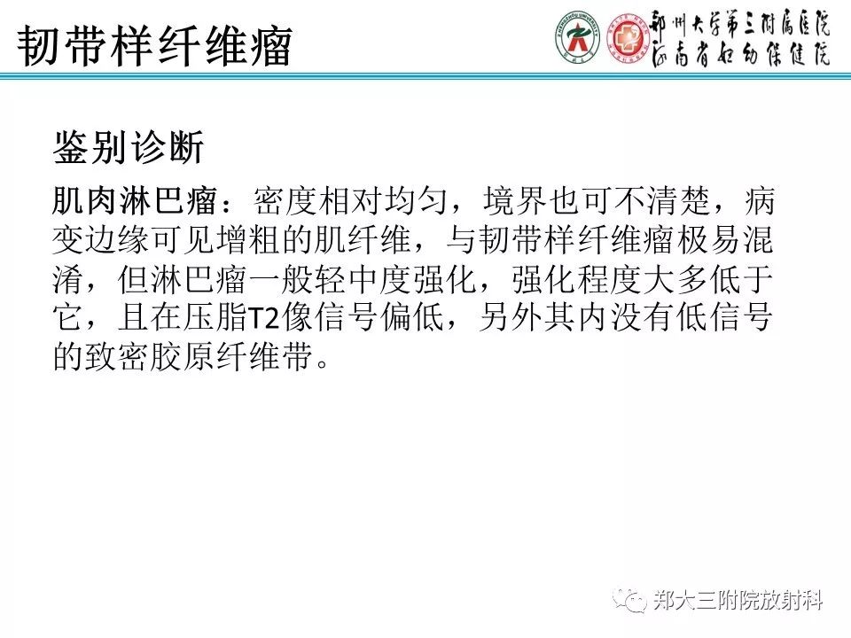 【PPT】韧带样纤维瘤