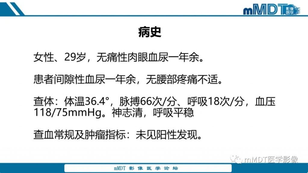 【PPT】肾髓质癌1例CT影像