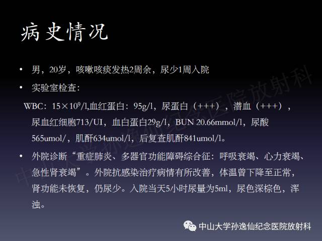 【PPT】肺出血的影像学特征