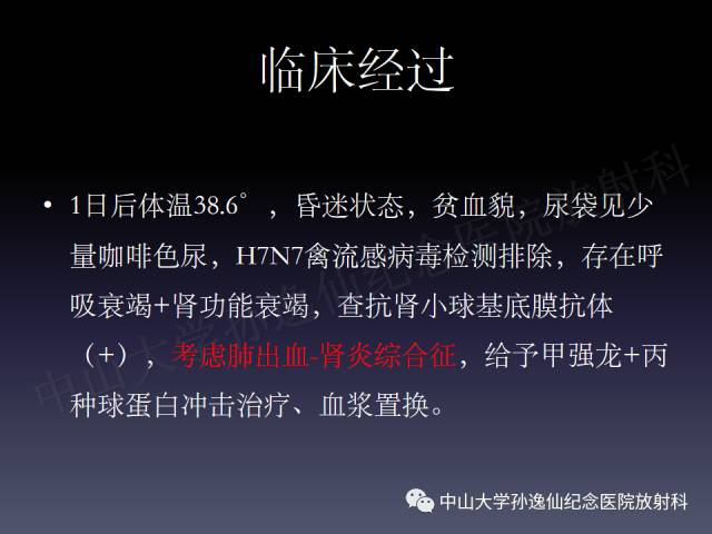 【PPT】肺出血的影像学特征