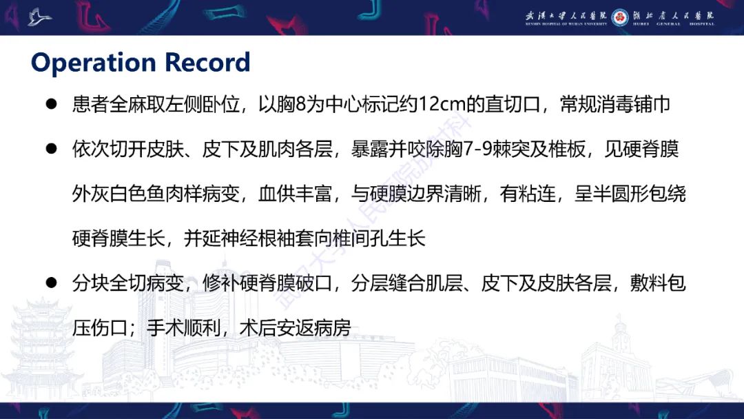 【PPT】原发性椎管内淋巴瘤影像诊断